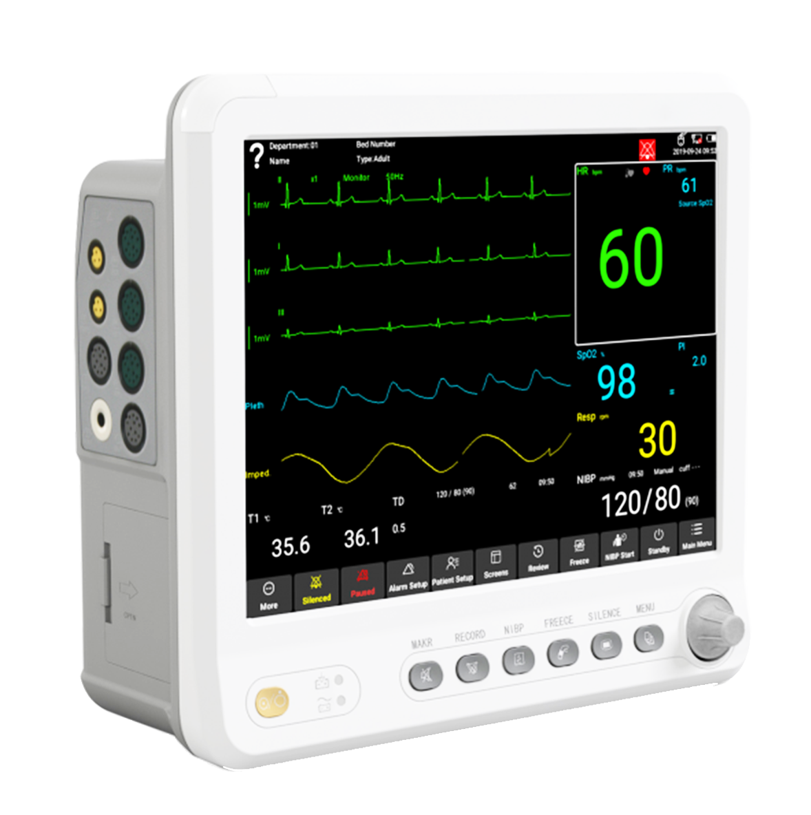MONITOR DE SIGNOS VITALES DE 5 PARÁMETROS