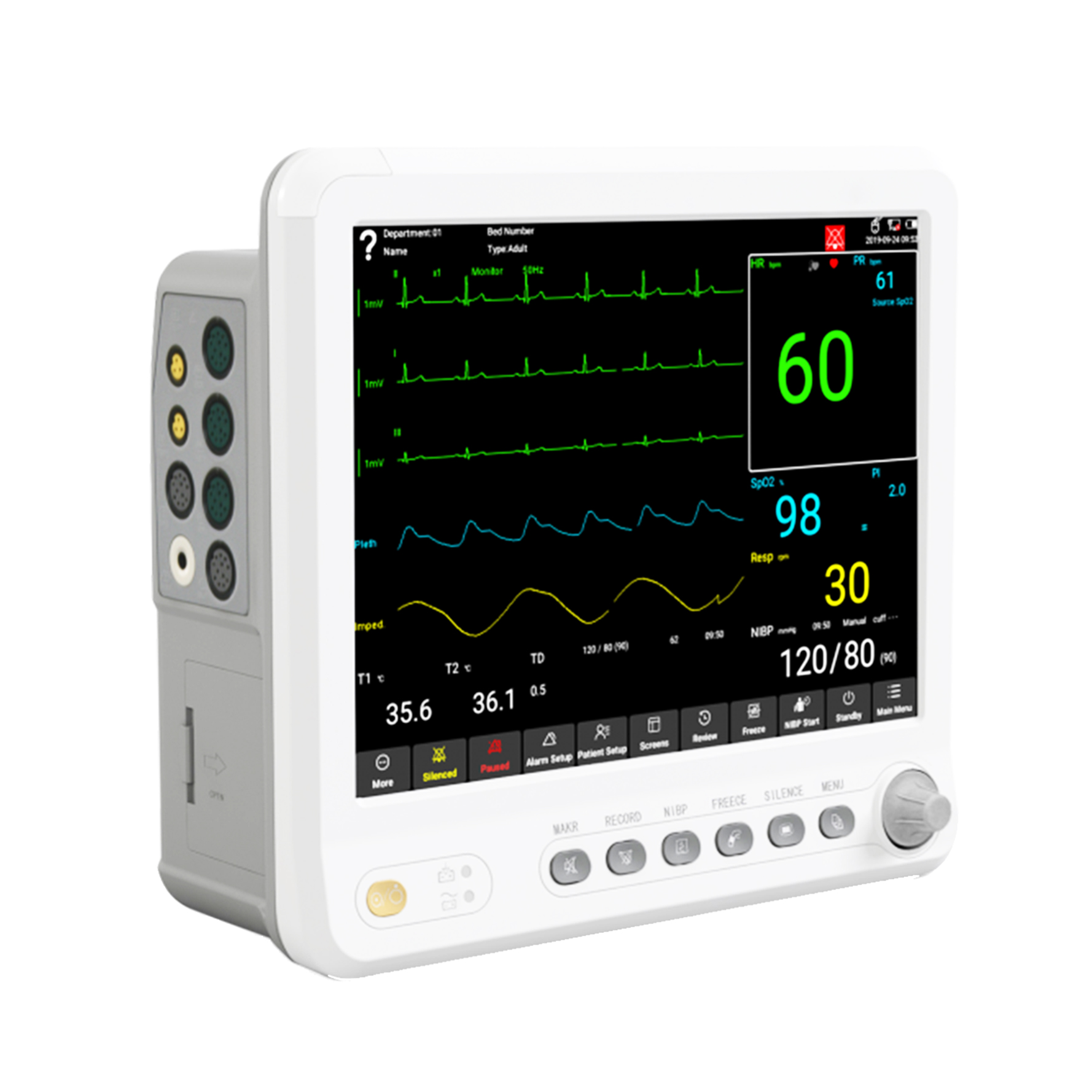 MONITOR DE SIGNOS VITALES DE 5 PARÁMETROS